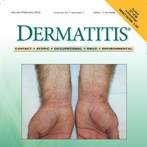 Dermatitis Journal | American Contact Dermatitis Society (ACDS)