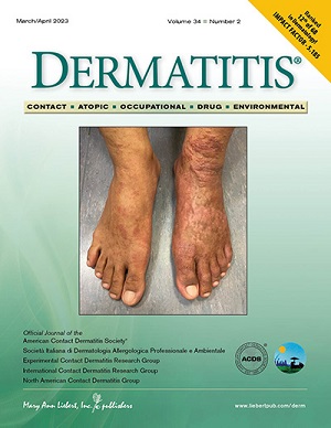 Dermatitis Journal | American Contact Dermatitis Society (ACDS)